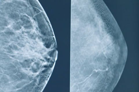 download solis mammography baylor all saints